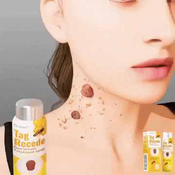 ULTIMAS 7 UNIDADES - Eliminador de Verrugas-Tag Recede® + Crema Aclarante + 3 REGALOS