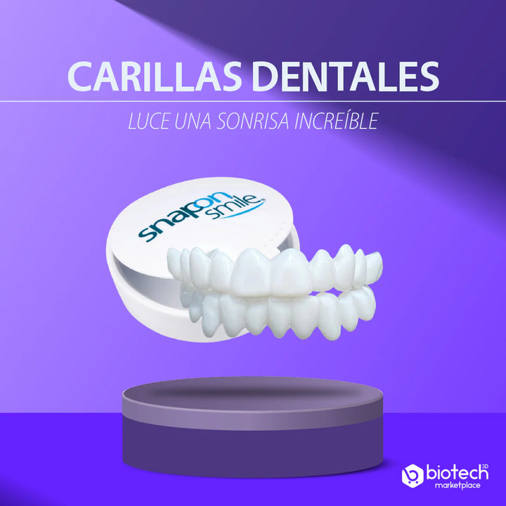 Carillas dentales