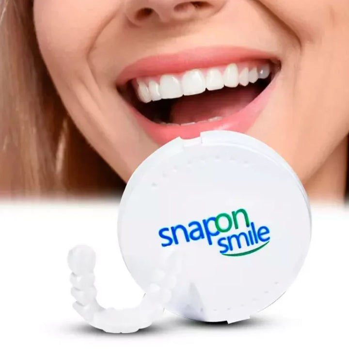 Carillas dentales